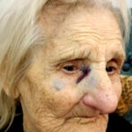 Lanús: brutal asalto a una mujer de 93 años que fue golpeada y desnudada en su casa